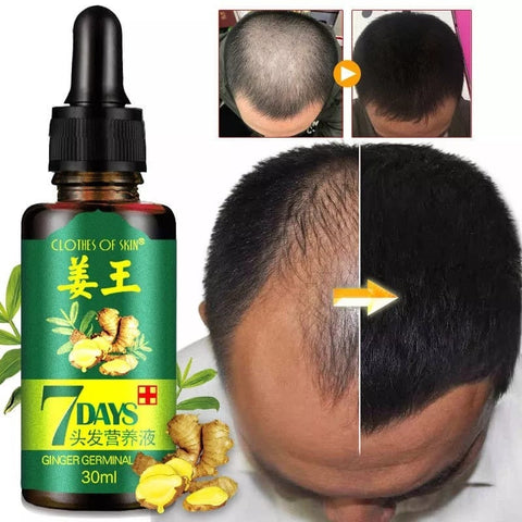Hair growth serum oil